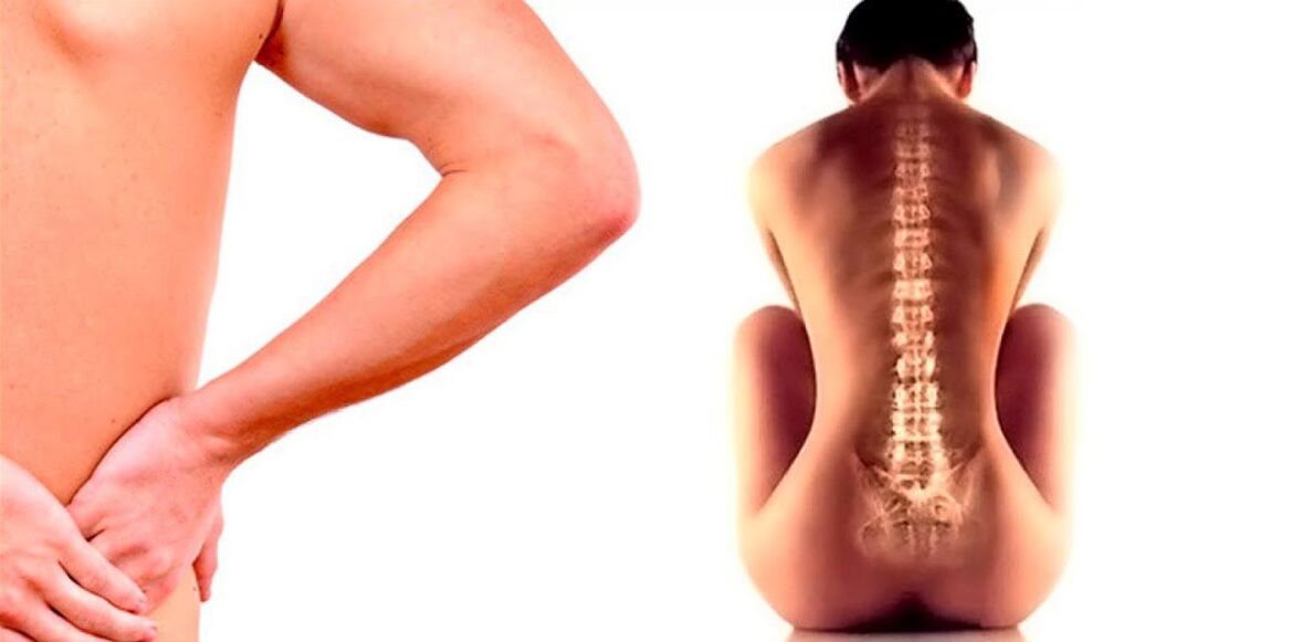 pain in the lower back due to osteochondrosis
