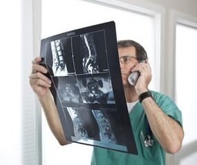Myelography for diagnosis of osteochondrosis and intervertebral hernias