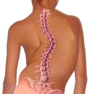 The curvature of the spine leads to osteochondrosis